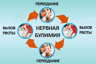 Лечение булимии в Бураево